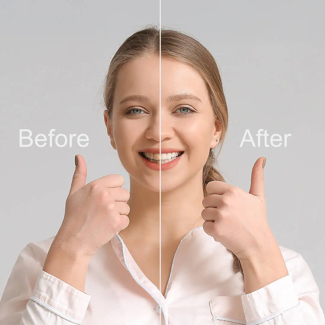 Cosmetic Smile Makeover Article