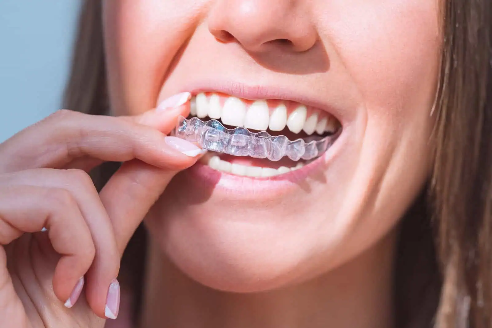 Invisalign clear aligners at Anaheim Smile Center