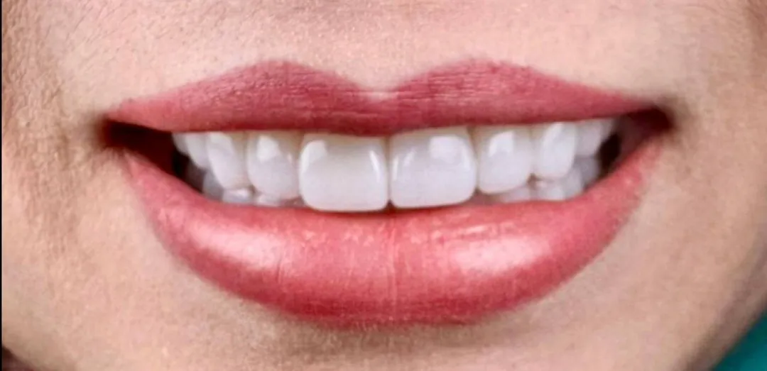After dental treatment