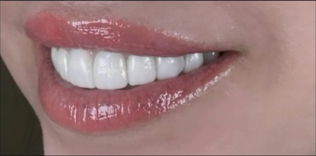 After dental treatment