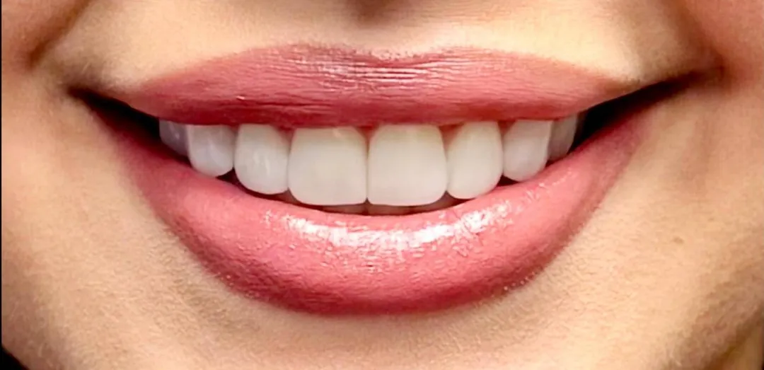 After dental treatment