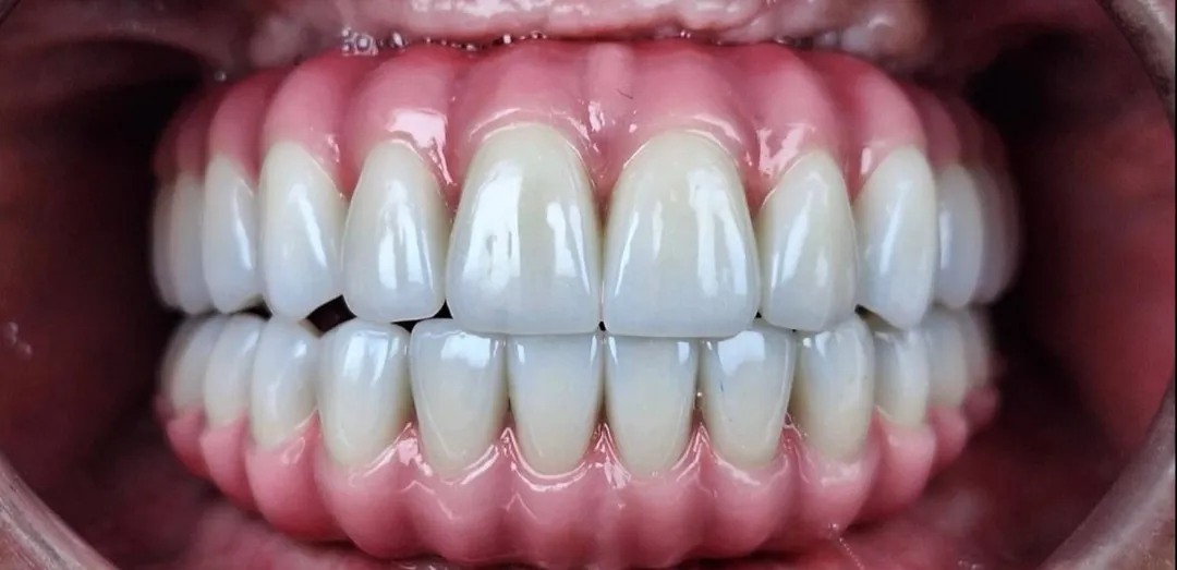 After dental treatment