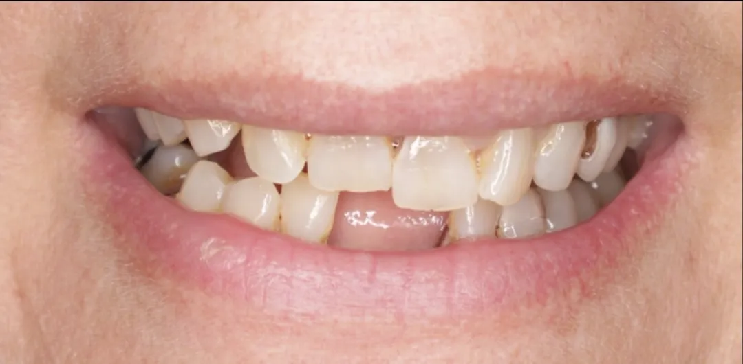 Before dental treatment