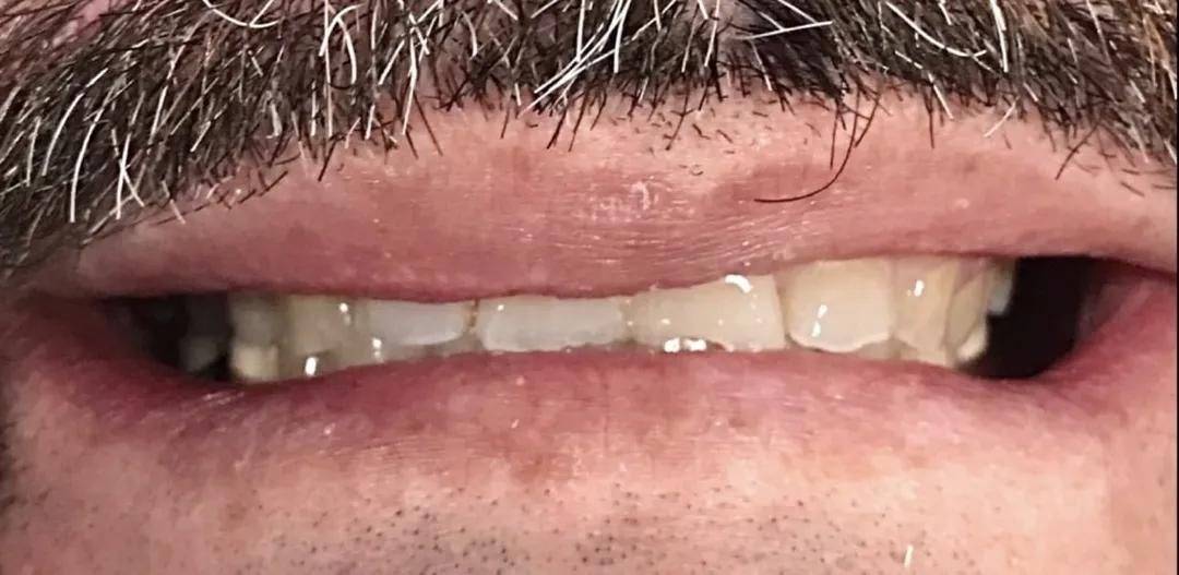 Before dental treatment