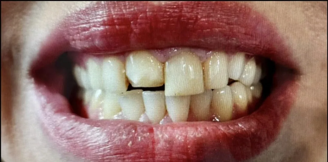 Before dental treatment