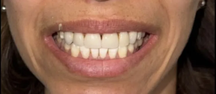 Before dental treatment