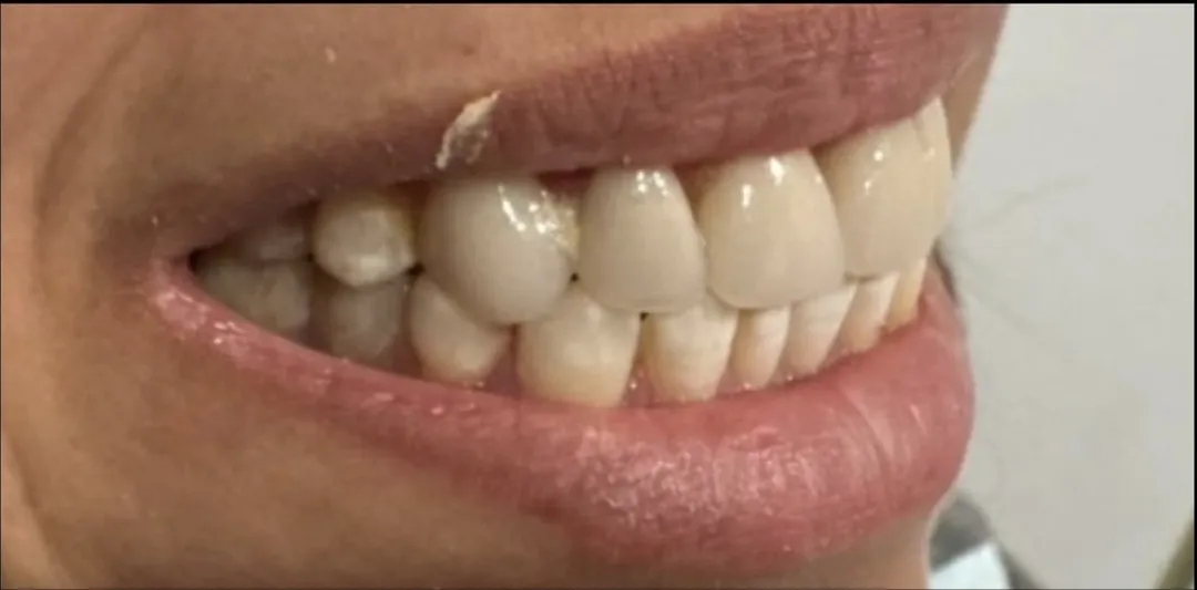 Before dental treatment