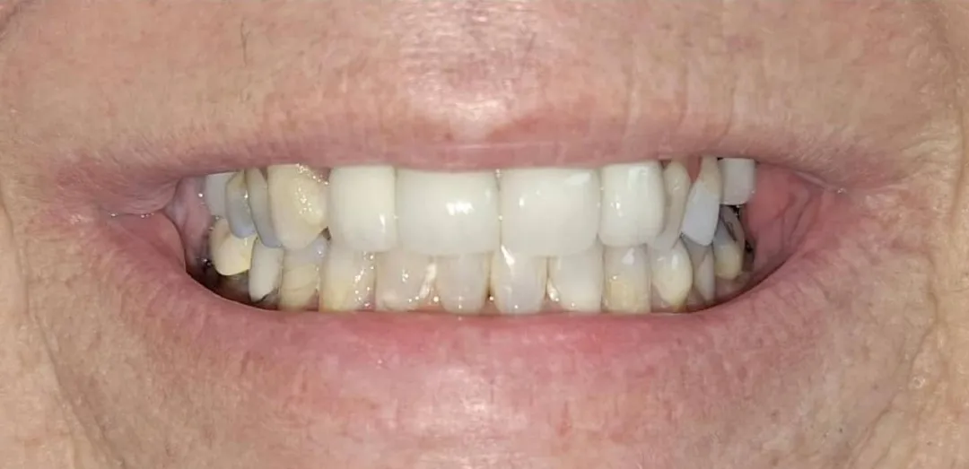 Before dental treatment