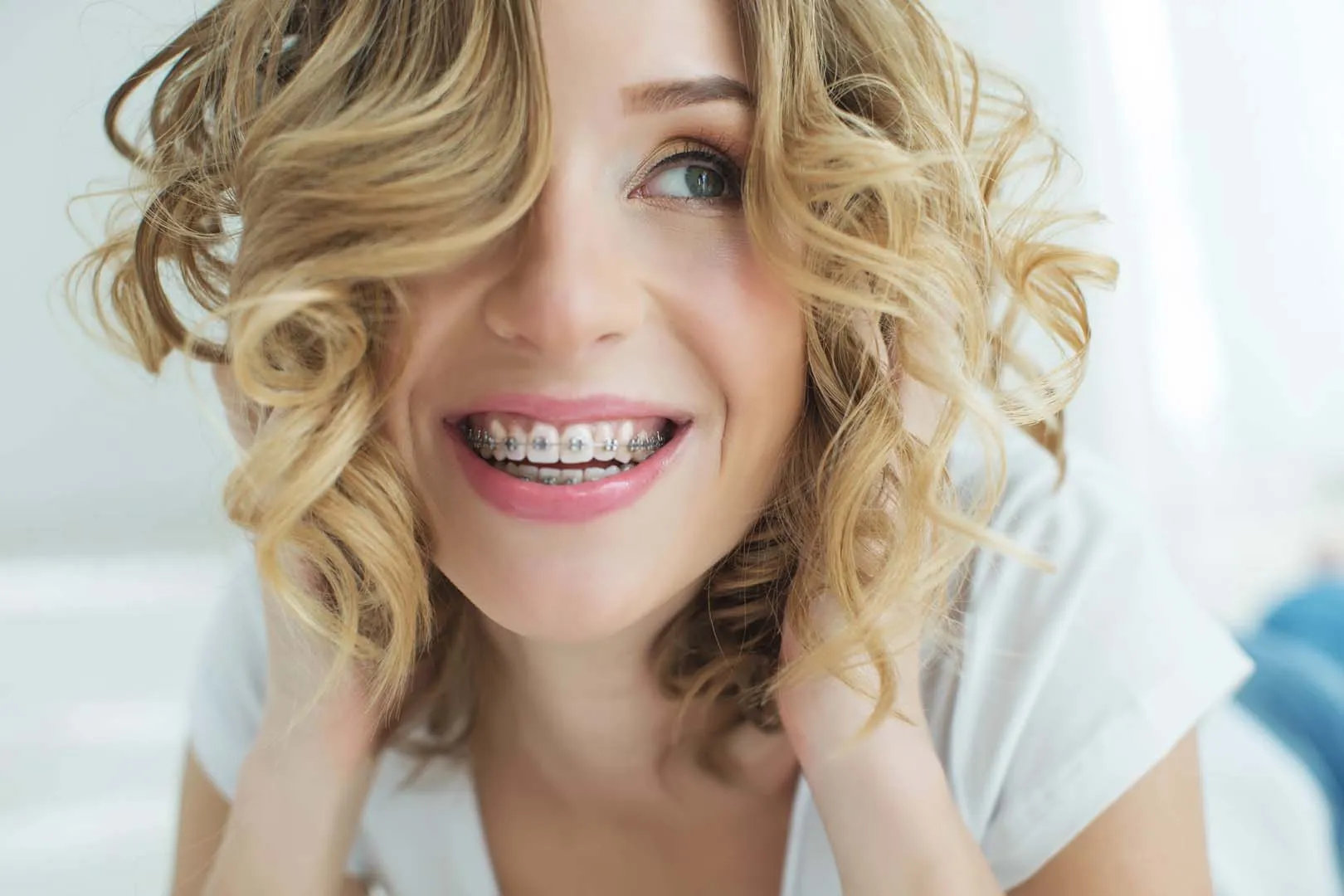 Braces at Anaheim Smile Center