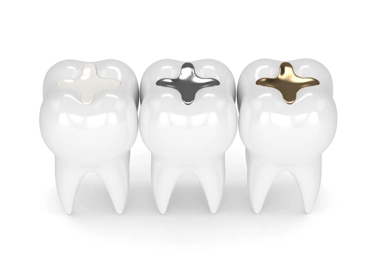 Fillings at Anaheim Smile Center