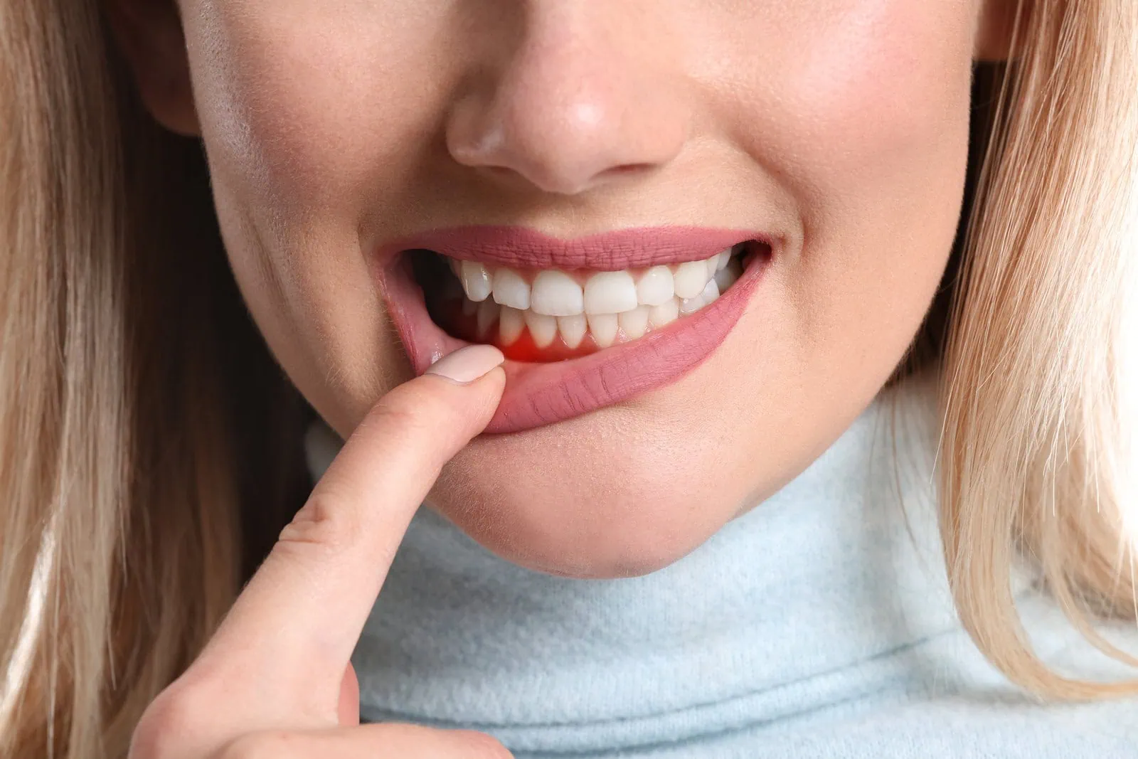 Periodontal Treatment at Anaheim Smile Center